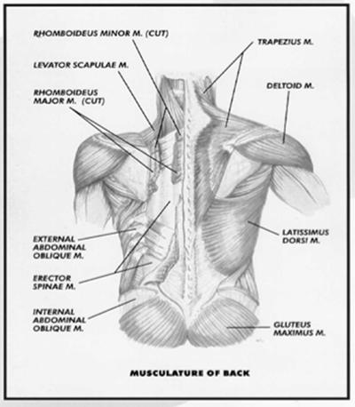 Lumbar strain Muscular pain and weakness Local lumbar pain with lateral
