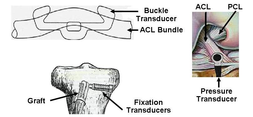 Figure 4. Contact Methodologies for estimating the force in the ACL in vivo - Fixation, Buckle, and Pressure Transducers 2.4.2 Noninvasive Non-Contact Methodologies Although few in number, there have been previous attempts to develop noninvasive, non-contact methodologies to estimate the force in the ACL.
