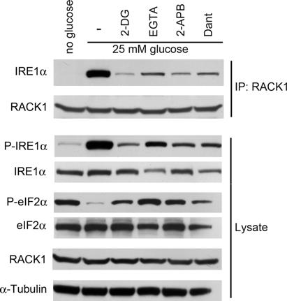 Fig. S5. Glucose metabolism and intracellular calcium mobilization are required for glucose stimulation of IRE1 phosphorylation and IRE1 RACK1 interaction in - cells.