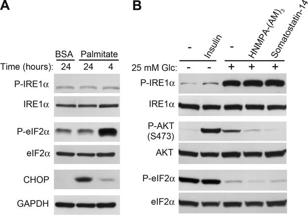 Fig. S4. Palmitate and insulin do not affect IRE1 phosphorylation. (A) INS-1 -cells maintained in 5 mm glucose for 18 hours were cultured in the presence of 0.4 mm palmitate and 0.4% BSA or 0.