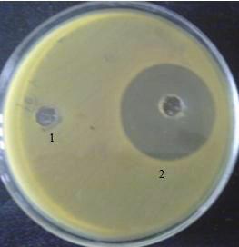 31 - Antibacterial activity of Lupeol,