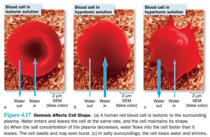 The red blood cell shrinks. The appearance of thin red blood cell indicates that it loses water by osmosis. Therefore, the cell membrane will not burst.