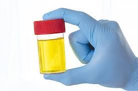 Question 9 A good colour for your urine to be to ensure you