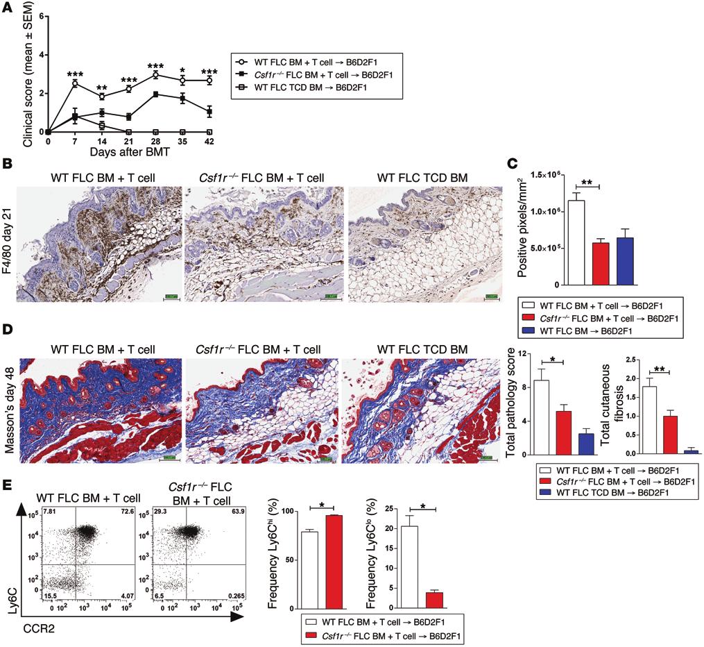 Figure 6. F4/80 + macrophage infiltration and cutaneous fibrosis following BMT are CSF-1/CSF-1R dependent.