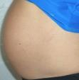 Figure 4 shows the usual big belly at 6 months (left), but then a much more manageable belly at nearly full term when