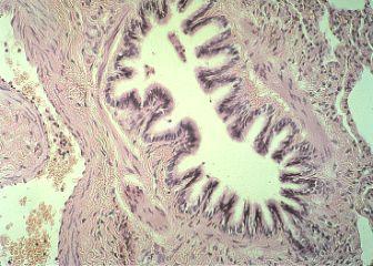with occasional goblet cells. B-Lamina propria: C.T. rich in elastic fibers.