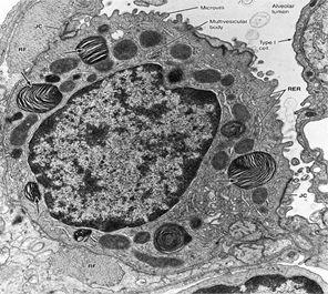 With central & rounded Nucleus. The cytoplasm contains membrane-bound Lamellar bodies (contain pulmonary surfactant).