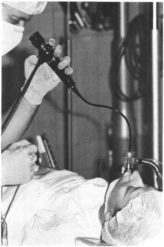 614 CANADIAN ANAESTHETISTS' SOCIETY JOURNAL FieunE 4. A ventilator adapter for flbreoptic bronchoscopy, The adapter can be obtained from Industrial Medical Products Ltd., P.O. Box 145, Newmarket, Ontario.