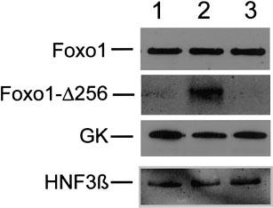 E724 Fig. 4. Western blot. Treated CD1 mice were killed after 1 wk of hepatic Foxo1-256 expression.