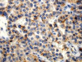Remarkably, the GS-9A8 antibody clone used for proinsulin immunostaining does not cross-react with human insulin or c-peptide, providing an unbiased picture of