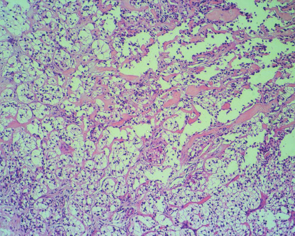 ody. c d Figure 2 Histologicl spects of the incisionl nd excisionl