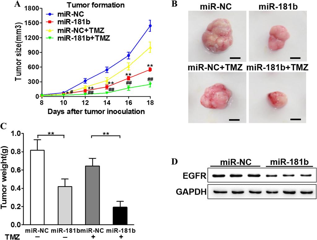 Fig. 5 MiR-181b enhances the chemo-sensitivity of temozolomide (TMZ) in vivo.