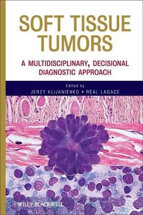 Proposed cytological classification Low-grade spindle cell tumors Tumors with fibrillary stroma Malignant
