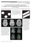 The Future for Diffusion Tensor Imaging in Neuropsychiatry