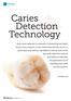 Caries Detection Technology