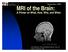 MRI of the Brain: A Primer on What, How, Why, and When. September Amit Malhotra, Harvard Medical School, Year- IV. Gillian Lieberman, MD