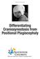Department of Neurosurgery. Differentiating Craniosynostosis from Positional Plagiocephaly