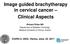 Image guided brachytherapy in cervical cancer Clinical Aspects