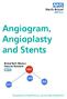 Angiogram, Angioplasty and Stents