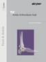 Foot & Ankle T2. Ankle Arthrodesis Nail. Foot & Ankle
