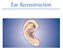 EAR RECONSTRUCTION. Reconstruction of the ear is one of MICROTIA