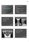 Radiographic Imaging. Standard Cervical Spine Series. Cervical Spine Imaging. Standard Cervical Spine Series. Cervical Spine Imaging 5/2/14