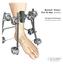 Biomet. Vision Pin-To-Bar System. Surgical Technique. Calcaneal Reduction Frame