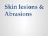 Skin lesions & Abrasions