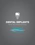 DENTAL IMPLANTS. What You Need to Know