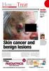 Skin cancer and benign lesions