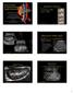 Transducer Selection. Renal Artery Duplex Exam. Renal Scan. Renal Scan Echogenicity. How to Perform an Optimal Renal Artery Doppler Examination