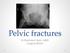 Pelvic fractures. Dr Raymond Yean, MBBS Surgical SRMO