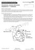 Percutaneous coronary intervention (angioplasty) +/- rotablation