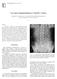 Case report: Imaging findings in a butterfly vertebra