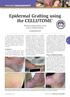 Epidermal Grafting using the CELLUTOME