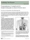 Nonvisualization of sentinel node by lymphoscintigraphy in advanced breast cancer