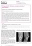 Periprosthetic fractures around total knee arthroplasty