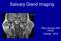 Salivary Gland Imaging. Mary Scanlon MD FACR October 2016