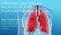 INTERSTITIAL LUNG DISEASES: FOCUS ON IDIOPATHIC PULMONARY FIBROSIS (IPF)
