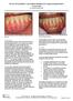 The Use of DynaMatrix Extracellular Membrane for Gingival Augmentation: A Case Series Dr. Stephen Saroff, DDS