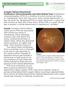 The Foundation. RETINA HEALTH SERIES Facts from the ASRS