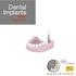 Dental Implants. Patient Information