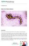 Ebola Virus Patient Advisory