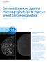 Contrast-Enhanced Spectral Mammography helps to improve breast cancer diagnostics