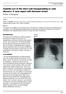 Hydatid cyst of the chest wall masquerading as cold abscess: A case report with literature review