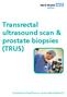 Transrectal ultrasound scan & prostate biopsies (TRUS)