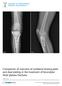 Comparison of outcome of unilateral locking plate and dual plating in the treatment of bicondylar tibial plateau fractures. Lee et al.