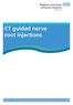CT guided nerve root injections