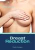 Breast. Reduction. Plastic Surgery