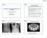 3/21/2011. Case Presentation. Management of Small Bowel Obstruction: An Update. CT abdomen and pelvis. Abdominal plain films